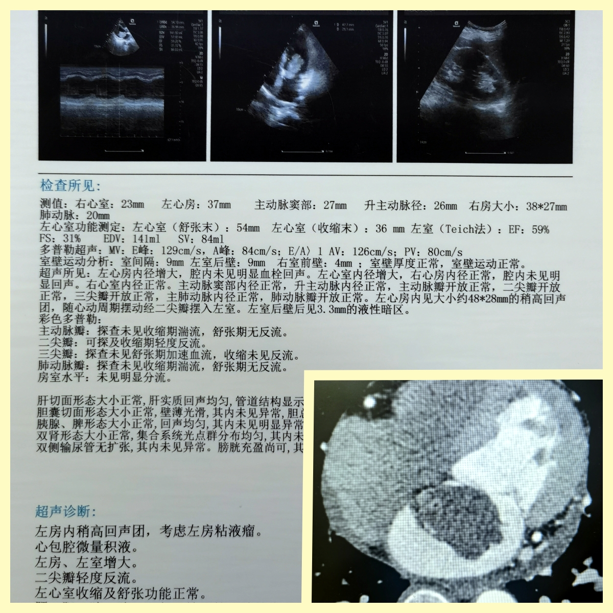 F94EB